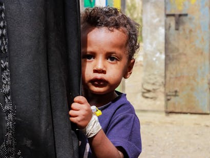 Eiad uit Jemen is 2 jaar oud en ondervoed